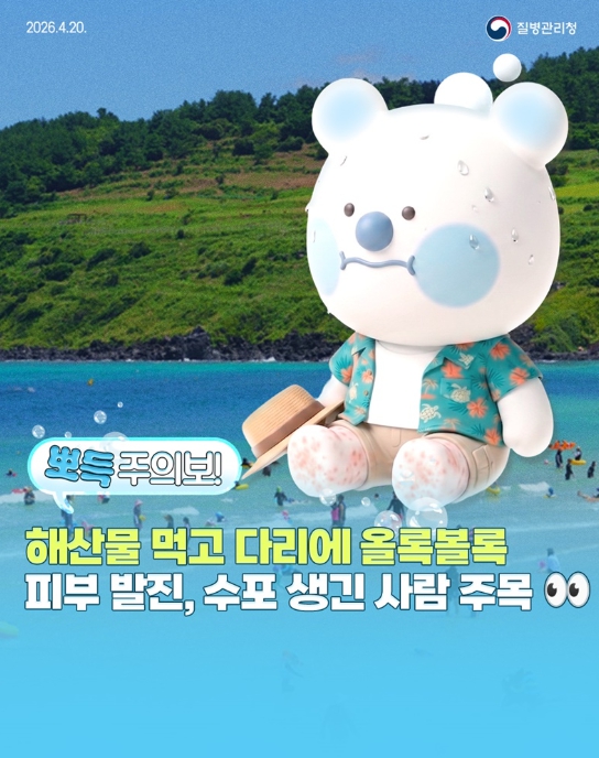 질병관리청, 해산물 먹고 다리에 올록볼록 수포 생긴 사람 주목!